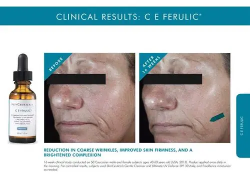 C E ferulic before and after