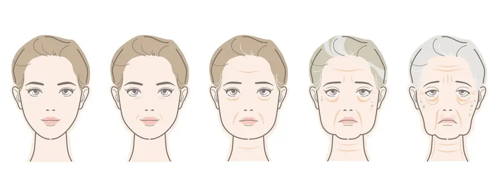 Timeline of facial aging